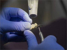 PROTETİK DİŞ TEDAVİSİ